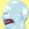 Dentures<br> Duchateau and DeChemant